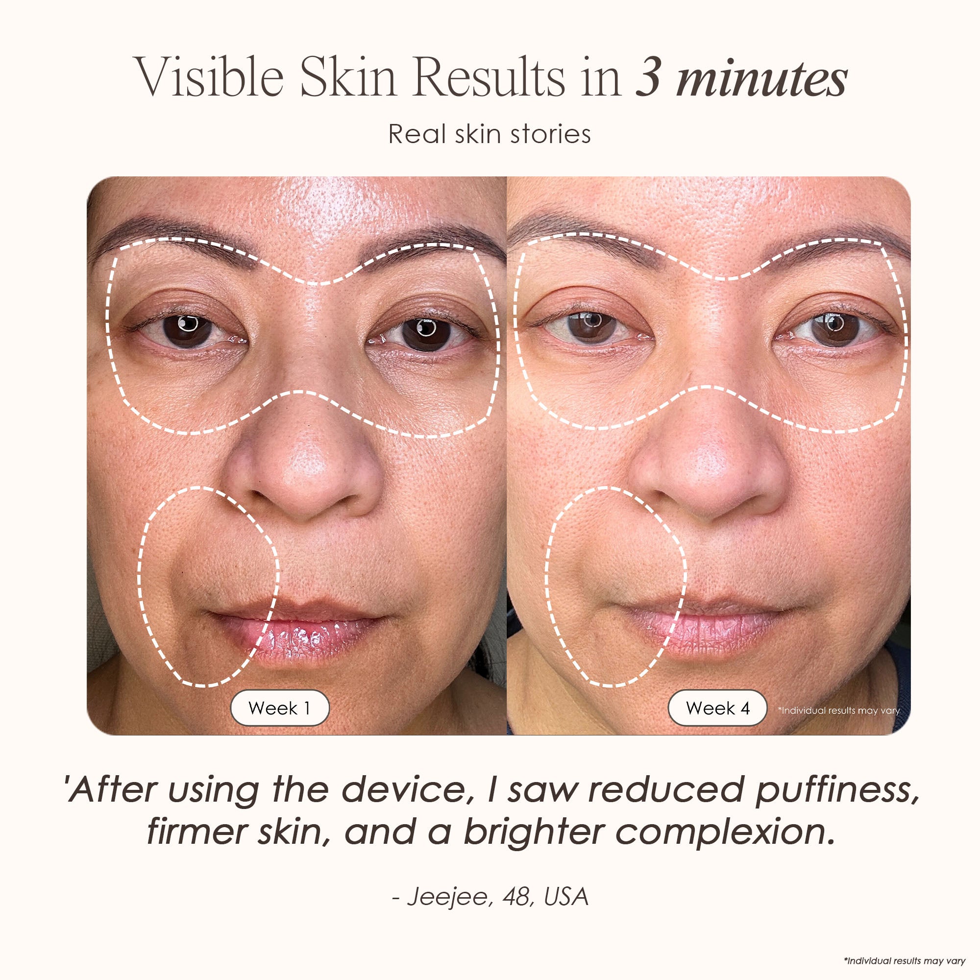 visible results after 4 weeks of using the LED light therapy mask