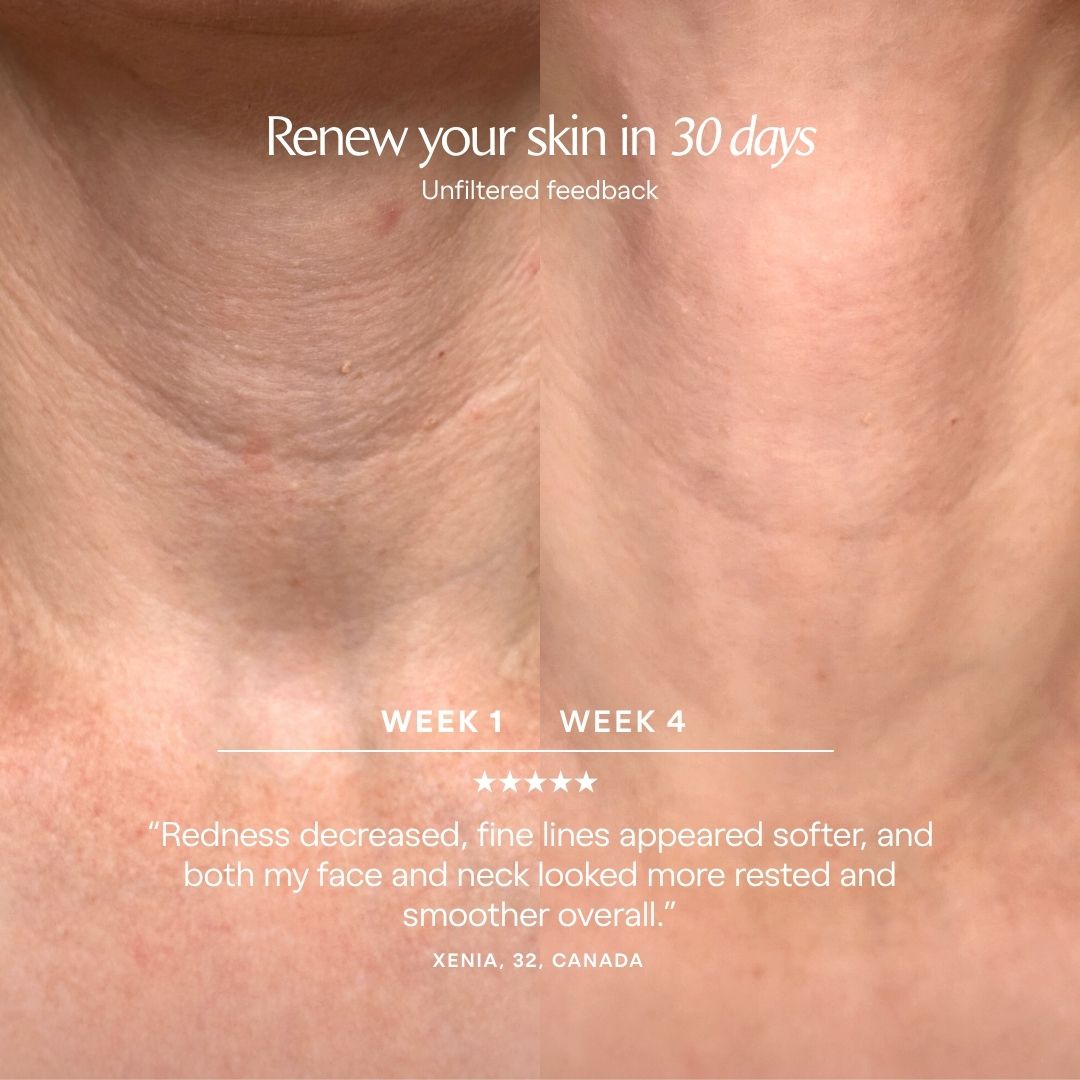 LumaLux Neck & Dec | Pro LED Red Light Therapy Mask