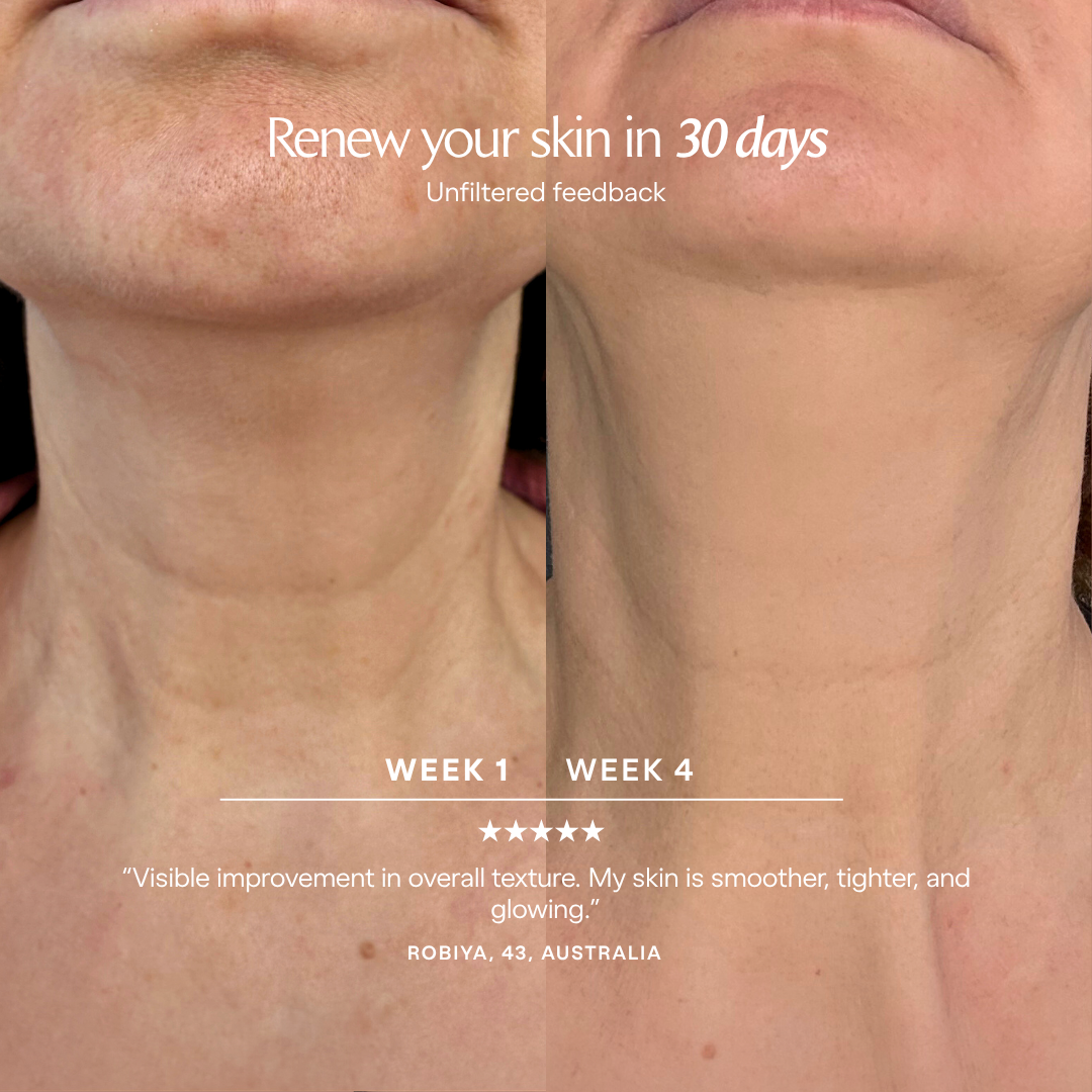 LumaLux Neck & Dec | Pro LED Red Light Therapy Mask